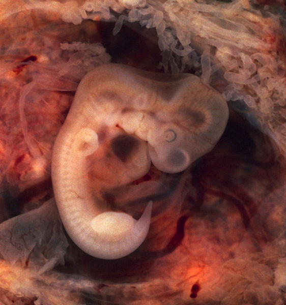 A photograph of a 5 week old human embryo.